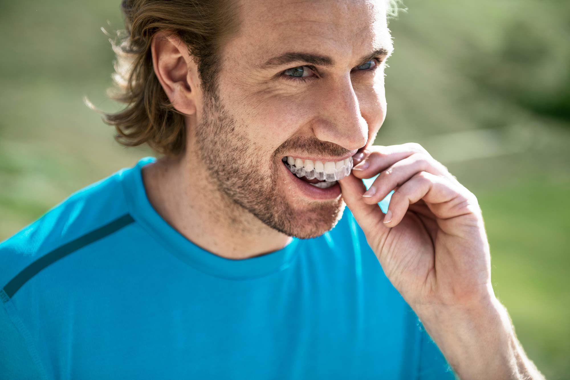 Invisalign apparecchio indossaggio