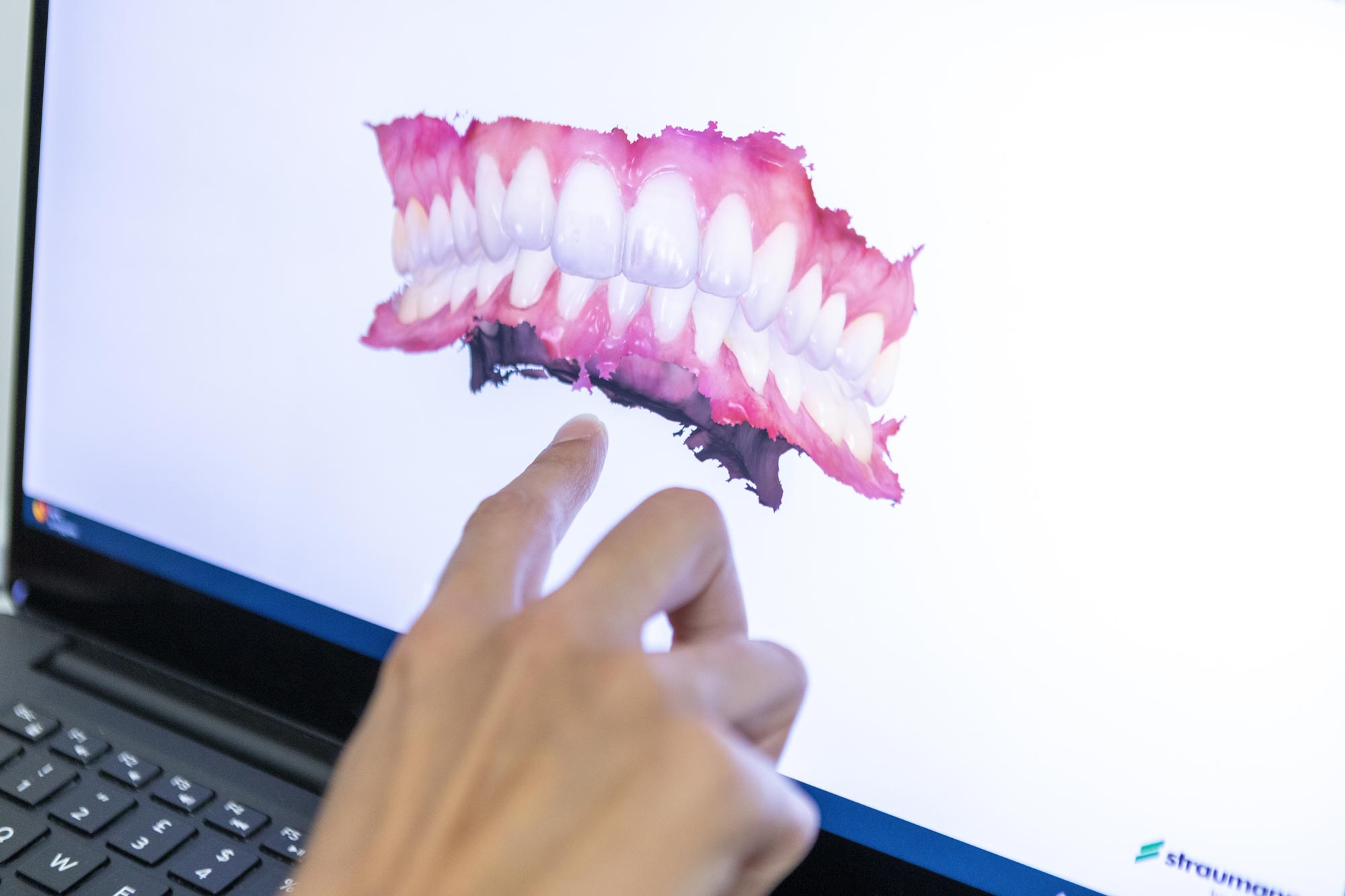 modello 3d scansione dentistica