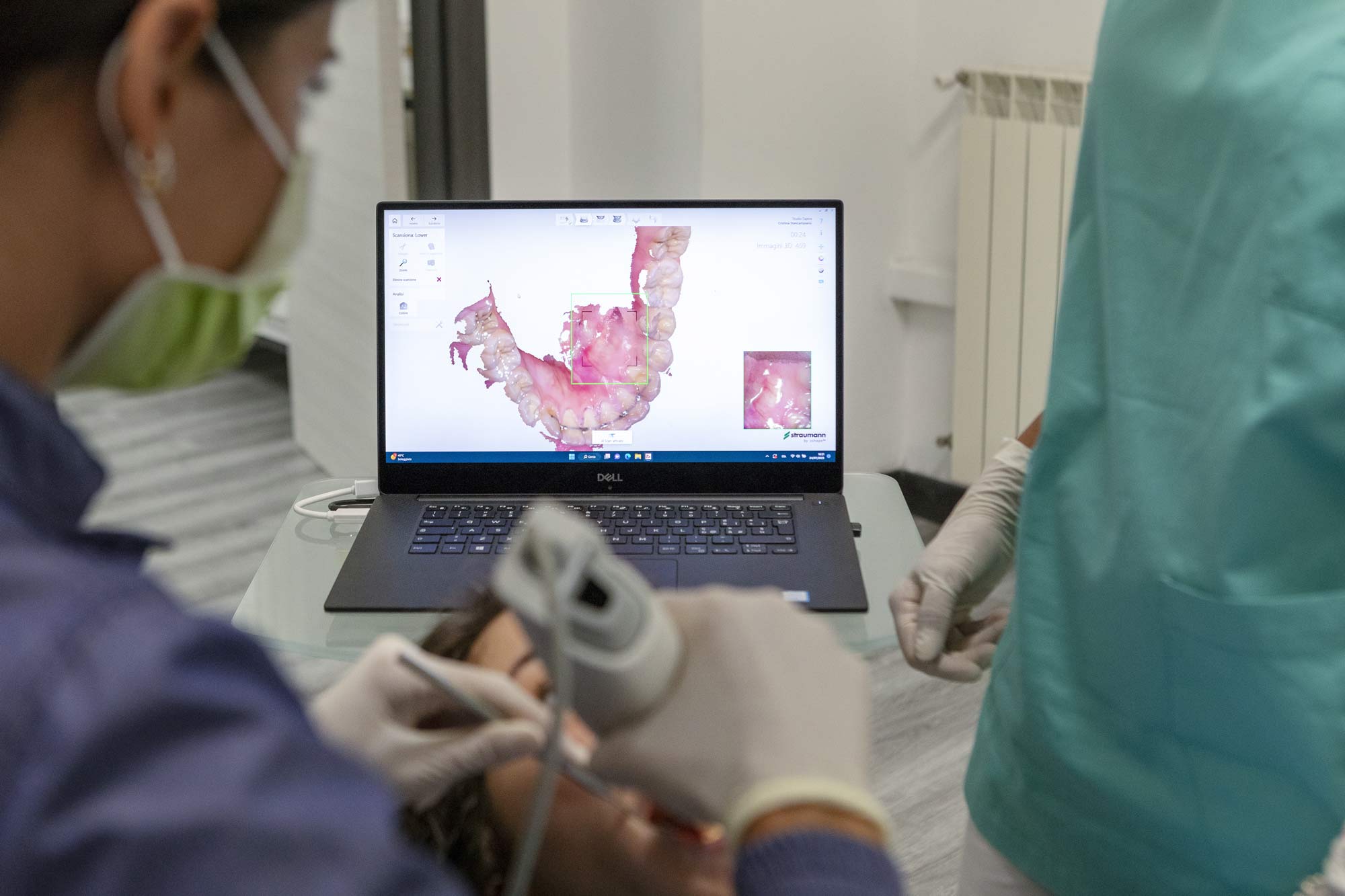 scansione 3d arcata dentale