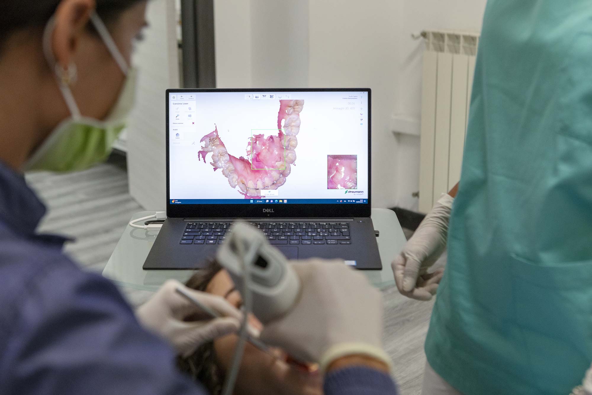 scansione 3d arcata dentale scansione 3d arcata dentale